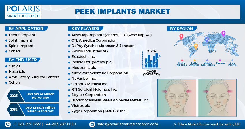 Peek Implants Market Size